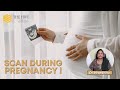 Scan during pregnancy  the hive fertility clinic  womens center