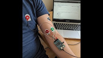 Real-Time ECG Monitoring with ESP8266