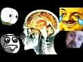 Forsen Reacts to A Woman Drank "35% Food Grade Hydrogen Peroxide" This Is What Happened To Her Brain