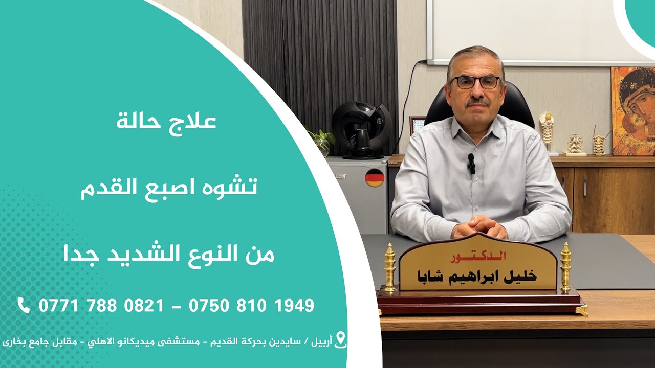 علاج حالة تشوه اصبع القدم من النوع الشديد جدا