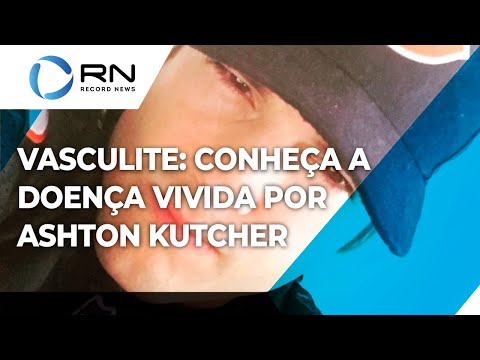 Vídeo: Filhote De Cachorro Torturado Até Que Perdeu A Vista, Agora Vai Viver Uma Vida Cheia De Alegria