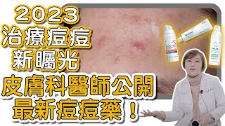 大家都在詢問的新青春痘治療用藥居然可以避免痘痘變成痘疤它是如何治療青春痘的