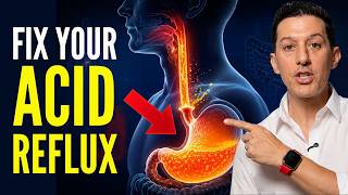 Stop Eating These 10 Foods If You Have Acid Reflux or GERD