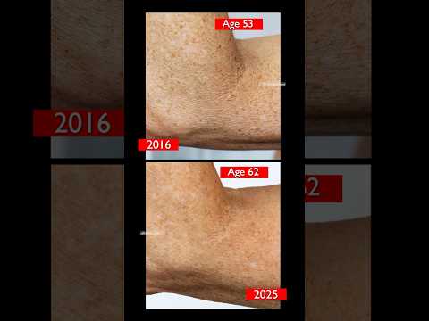 BEST Skincare for CREPEY Body Skin! #skincare #over40skincare #crepeyskinfix