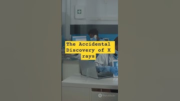 The Accidental Discovery of X rays #shortvideo #viralvideo #shots #top #facts #future #Video #life