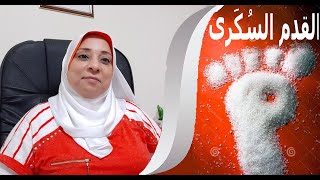 القدم السكري مع د/هيام