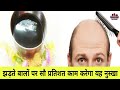 झड़ते बालों पर सौ प्रतिशत काम करेगा यह नुस्खा, अजमा कर देख ले/ beauty tips in Hindi