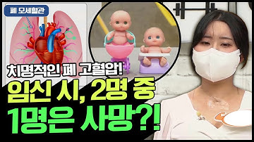 [Balance of Life] 폐 고혈압 환자 임신 시 2명 중 1명은 사망?! 심장에 