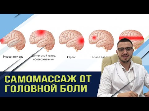 Как лечить ГОЛОВНУЮ боль