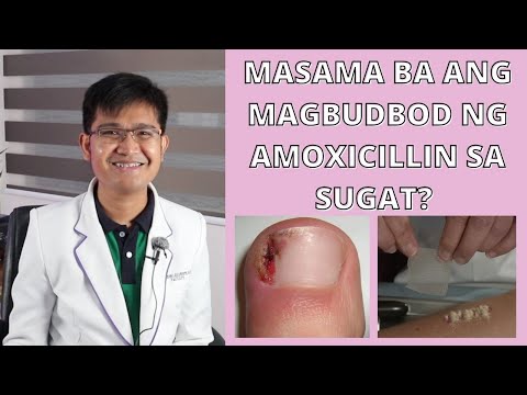 Video: 3 Mga Paraan upang Gamutin ang isang Sugat na Nilikha ng isang Na-impaled na Bagay