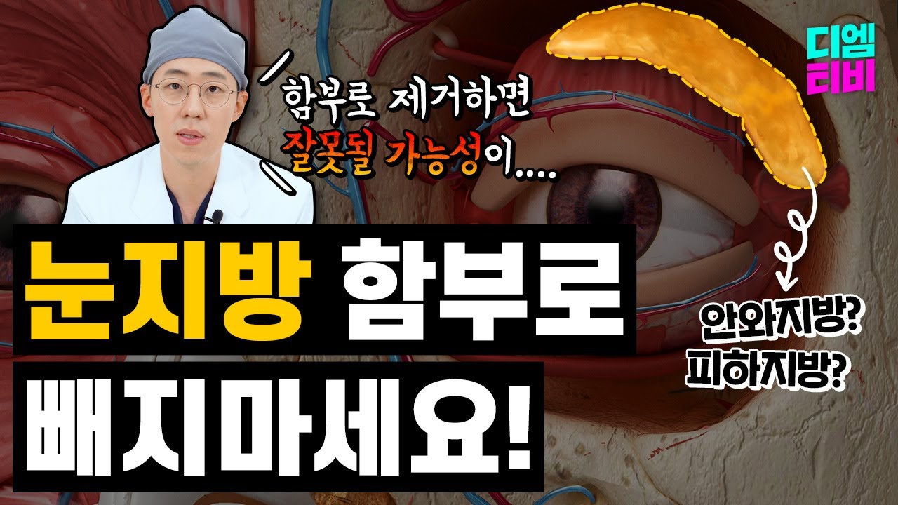 눈지방 함부로 빼지마세요!! 이거 중요합니다... #눈지방 #눈성형 #지방제거 #디엠성형외과