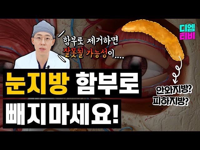 눈지방 함부로 빼지마세요!!  이거 중요합니다...    #눈지방 #눈성형 #지방제거 #디엠성형외과