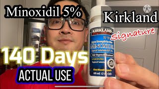 Minoxidil 5 Kirkland Actual Use 140 DAYS