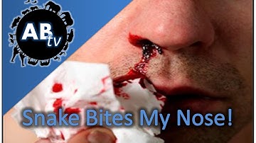 Snake Bites My Nose! SnakeBytesTV : AnimalBytesTV