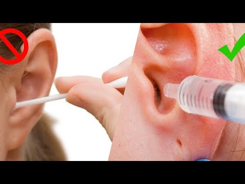 Wideo: Jak spuścić płyn z uszu (ze zdjęciami)