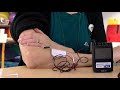 How to Use a TENS Unit