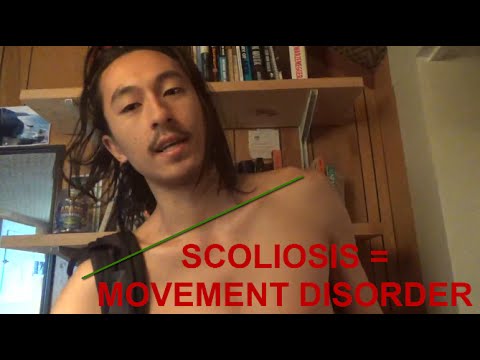 What How To Fix Scoliosis