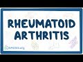 Rheumatoid arthritis  causes symptoms diagnosis treatment pathology