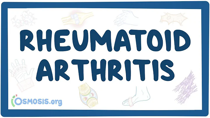 Rheumatoid arthritis - causes, symptoms, diagnosis, treatment, pathology - DayDayNews