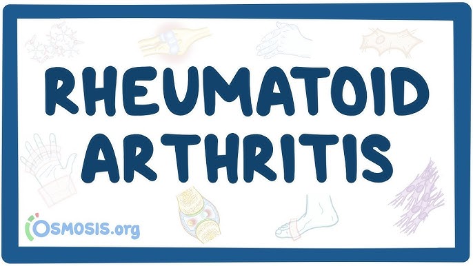 hogyan kezeljük a sarok rheumatoid arthritisét
