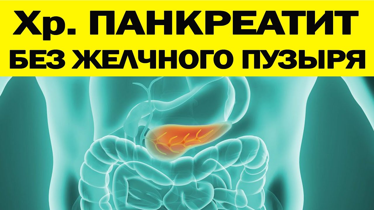 Хр. ПАНКРЕАТИТ при (из-за) УДАЛЁННОМ ЖЕЛЧНОМ ПУЗЫРЕ