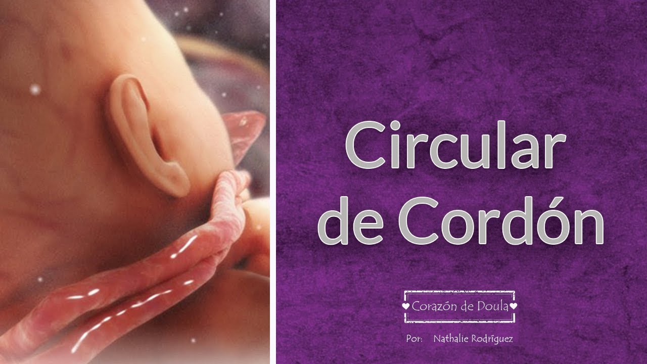 Que hacer cuando se cae el cordon umbilical