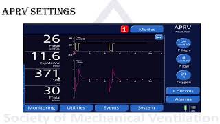 Modes of mechanical ventilation: Airway Pressure Release Ventilation (APRV) Modes of mechanical ventilation: Airway Pressure Release Ventilation (APRV)