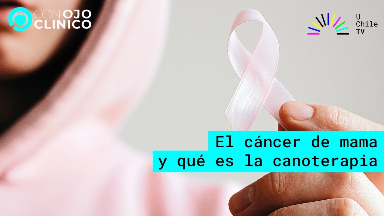 Con Ojo Clínico - CAP 56: Todo sobre el cáncer de mamas
