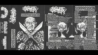 SULFURIC CAUTERY / SUPPRESSION - SPLIT