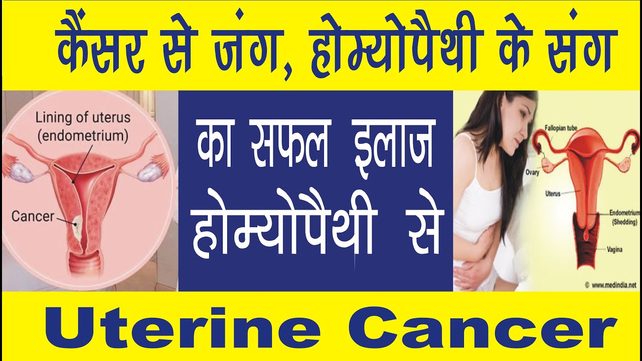 Endometrium Uterine Cancer stage 4 with metastasis Cured by Dr Arpit