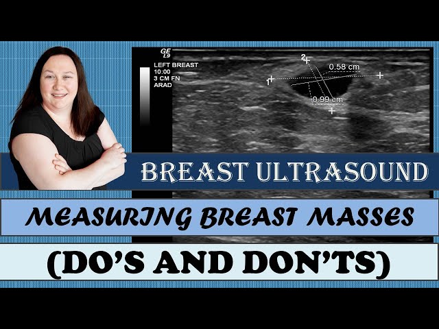 Breast Ultrasound - Measuring Breast Masses (Do's & Don'ts)