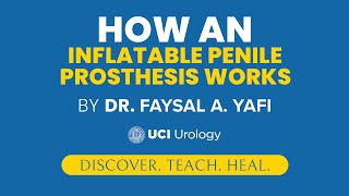 How an Inflatable Penile Prosthesis Works by Dr. Faysal A. Yafi - UCI Men's Health Center