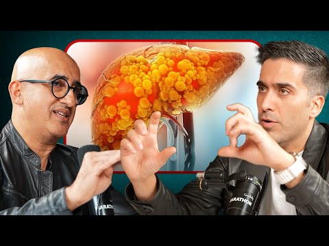 کبد چرب رو چجوری درمان کنیم 