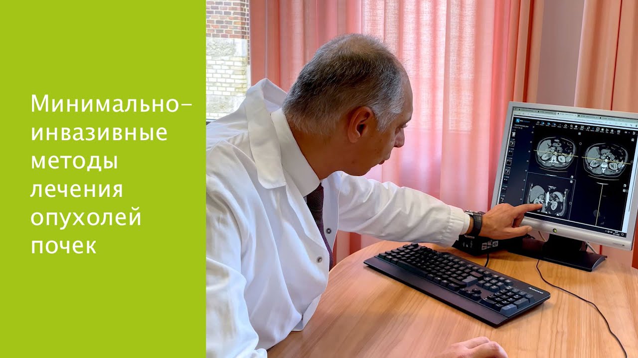 Опухоли почек: лечение в частной клинике "Дёблинг", Вена, Австрия
