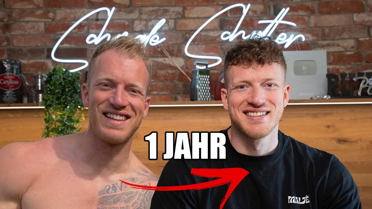 1 Jahr nach der Haartransplantation! Habe viel falsch gemacht.