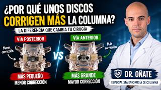 Discos intersomáticos anteriores: por qué corrigen más la columna en una sola cirugía