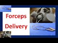 Forceps delivery  forceps assisted delivery  delivery with forceps