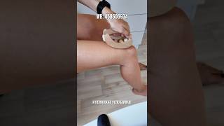 Как быстро убрать ЦЕЛЛЮЛИТ и ОТЕКИ лимфодренажный массаж #целлюлит #лимфодренажныймассаж #скалка