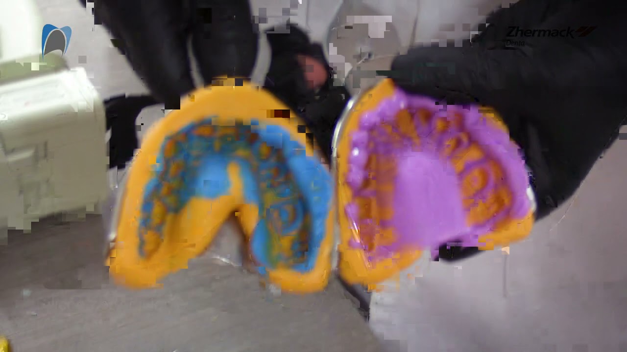 ¡Técnicas para la toma de IMPRESIÓN!