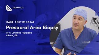 Micromate™ Case Testimonial | Biopsy in the presacral area