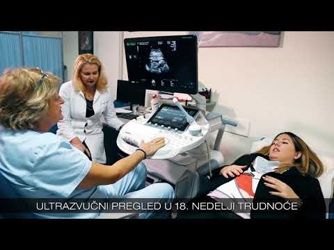 Video: Može li ultrazvuk u 18 sedmici odrediti spol?