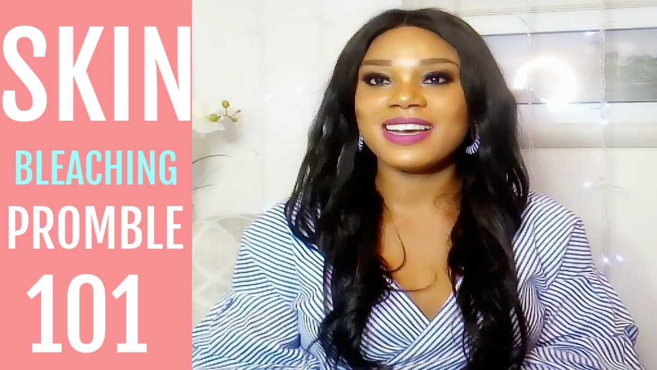 Every Girl Using Bleaching Cream Should Watch This Video - Green veins, White patches?