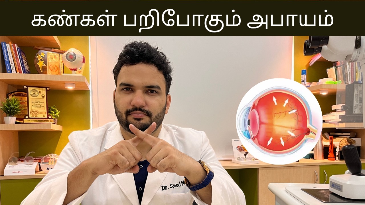 What is Silent Thief of Sight? | Tamil | Dr. Syed Moosa | Eye Doctor |