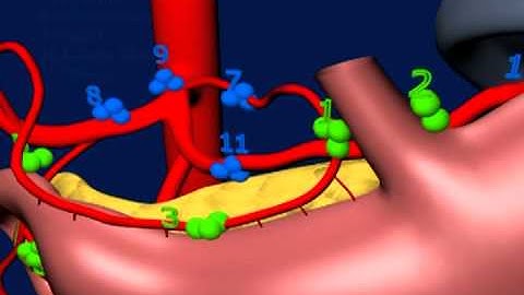 Stomach - Lymphatic Stations and Levels of Dissection (up to D3)