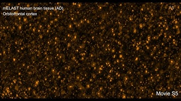 Technologies enable 3D imaging of whole human brain hemispheres at subcellular resolution
