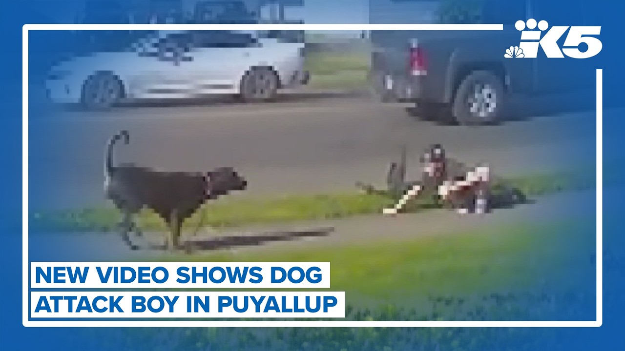 New video shows Puyallup boy attacked by dog - YouTube