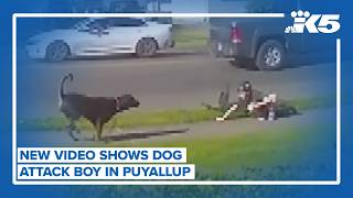 New Video Shows Puyallup Boy Attacked By Dog