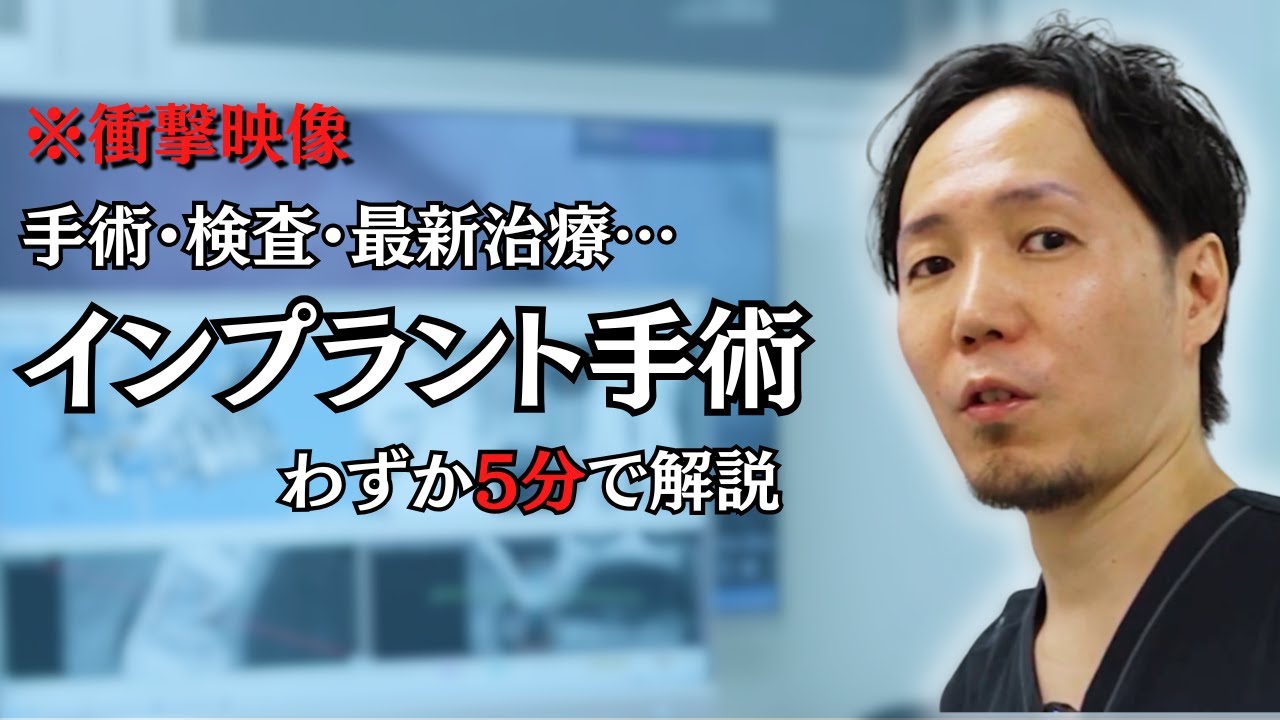 Shocking x Divine Technique] A 4-minute summary of the implant