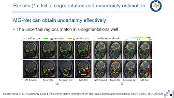 MICCAI 2020 paper:  Uncertainty-Guided Efficient Interactive Refinement of Fetal Brain Segmentation