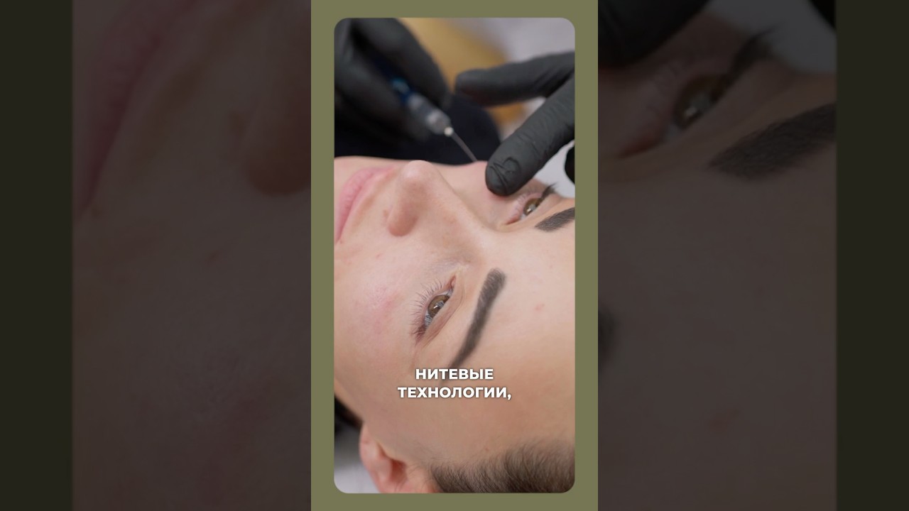 Тренд в косметологии. Как лечить птоз? #косметология #птоз #советыкосметолога